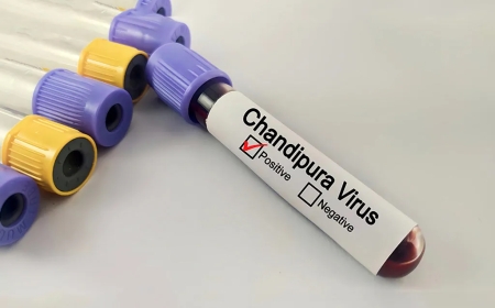 What Is Chandipura Virus? Symptoms, Causes, Treatment & Prevention Explained
