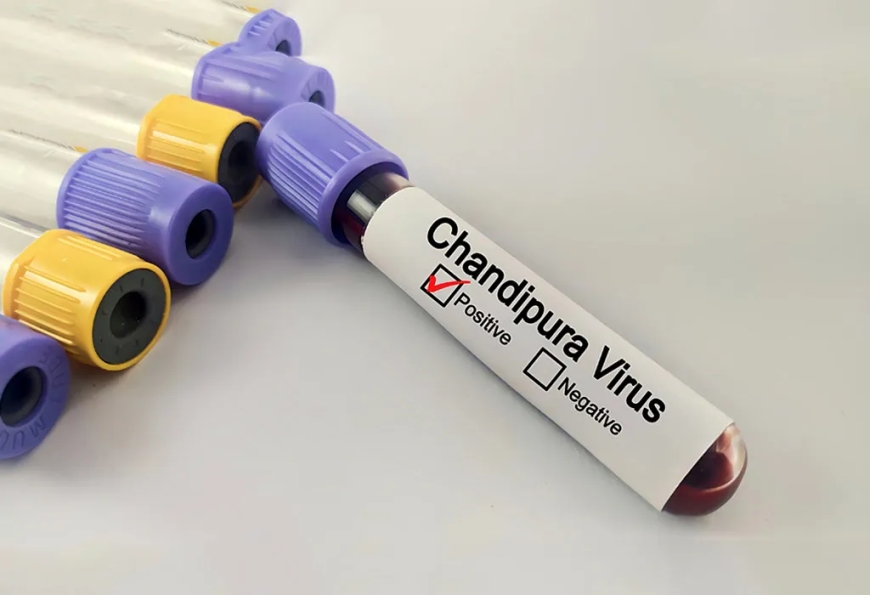 What Is Chandipura Virus? Symptoms, Causes, Treatment & Prevention Explained